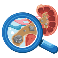 Kidney stone management